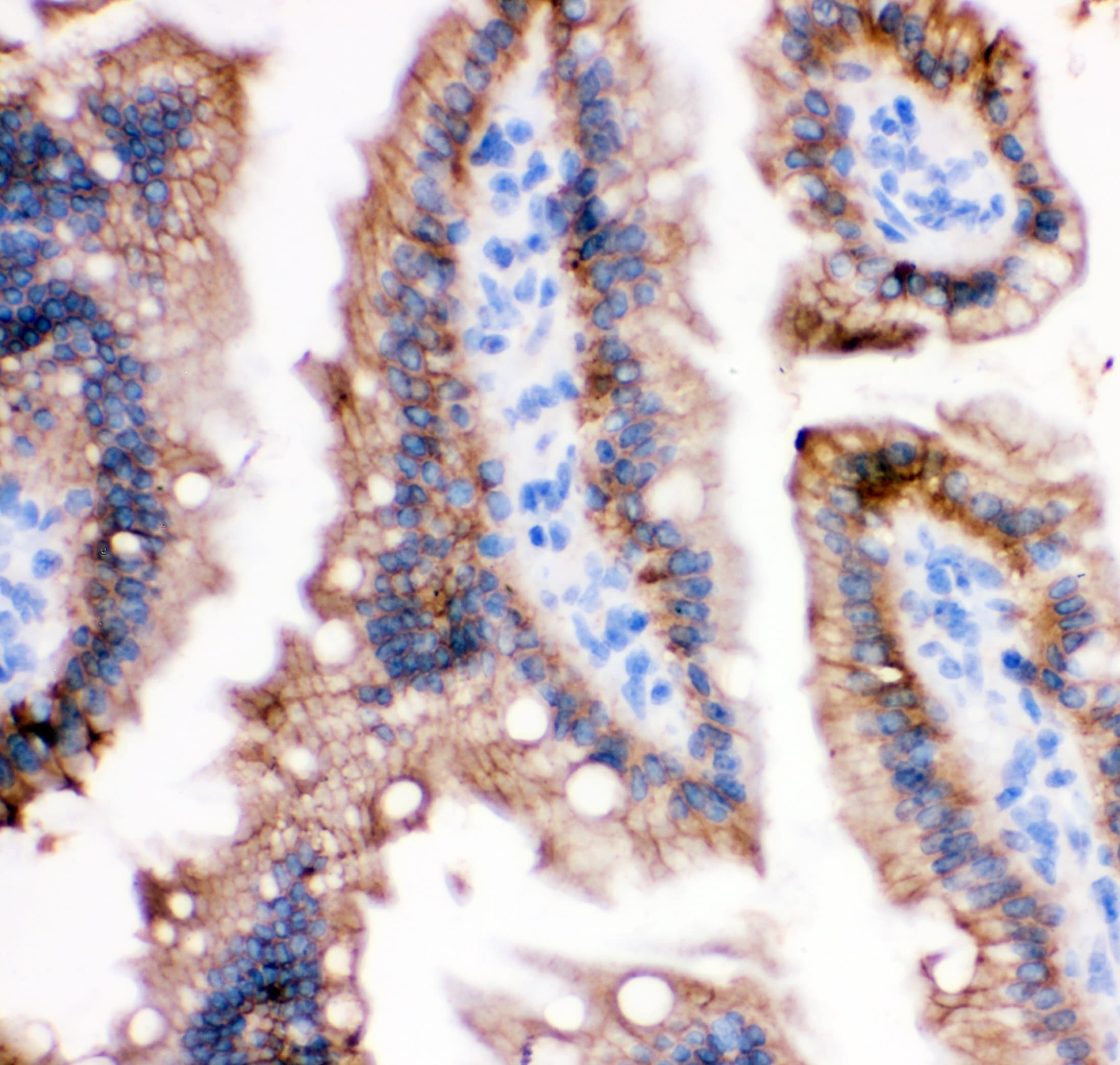 CDH1 / E Cadherin Antibody (aa286-703)