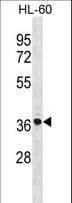 TNIP2 / ABIN-2 Antibody (aa165-194)