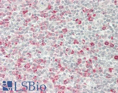 IHC-plus™ CTBP1 / CTBP Antibody