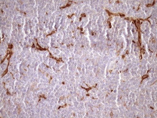 FSCN1 / Fascin Antibody (clone OTI5G1)
