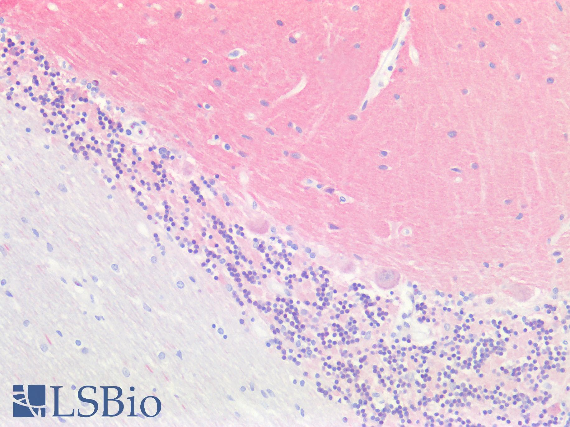 IHC-plus™ Polyclonal Rabbit anti-Human SH3GL2 Antibody (IHC, IF, WB)