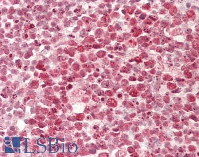IHC-plus™ LARP7 Antibody (aa1-50)