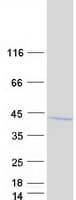 Human COPS6 / CSN6 Protein (Recombinant Myc-DDK (Flag))