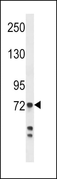 MPO / Myeloperoxidase Antibody (aa420-448)