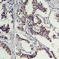 Monoclonal Mouse Phosphotyrosine Antibody (IHC, WB)