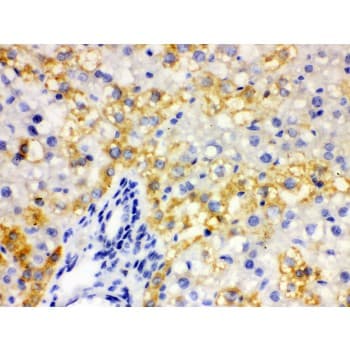 ALDH2 Antibody (aa18-48)