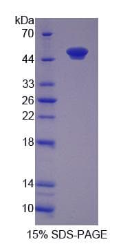 Rat MGMT Protein (Recombinant His-GST)