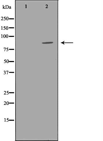 MME / CD10 Antibody