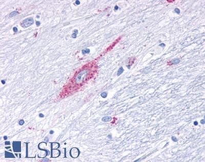 PathPlus™ MRGD / MRGPRD Antibody (Cytoplasmic Domain)