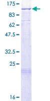 Human LARS2 / LEURS1 Protein (Recombinant GST)