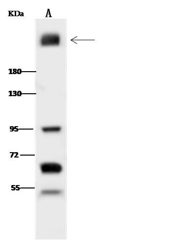 Polyclonal Rabbit anti-Mouse IGF2R / CD222 Antibody (Preservative Free, IHC, WB)
