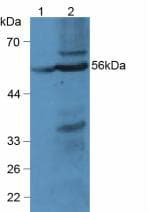 MBOAT5 / C3F Antibody (aa122-233, PE)