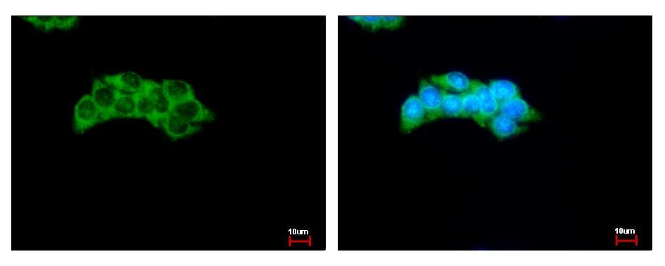 PKLR Antibody (aa1-260)