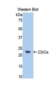 CSF3R / CD114 Antibody (aa271-428)