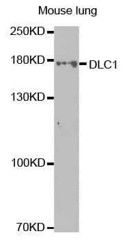 DLC1 Antibody