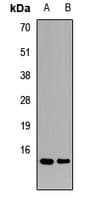Polyclonal Rabbit anti-Human TAX1BP3 Antibody (WB)