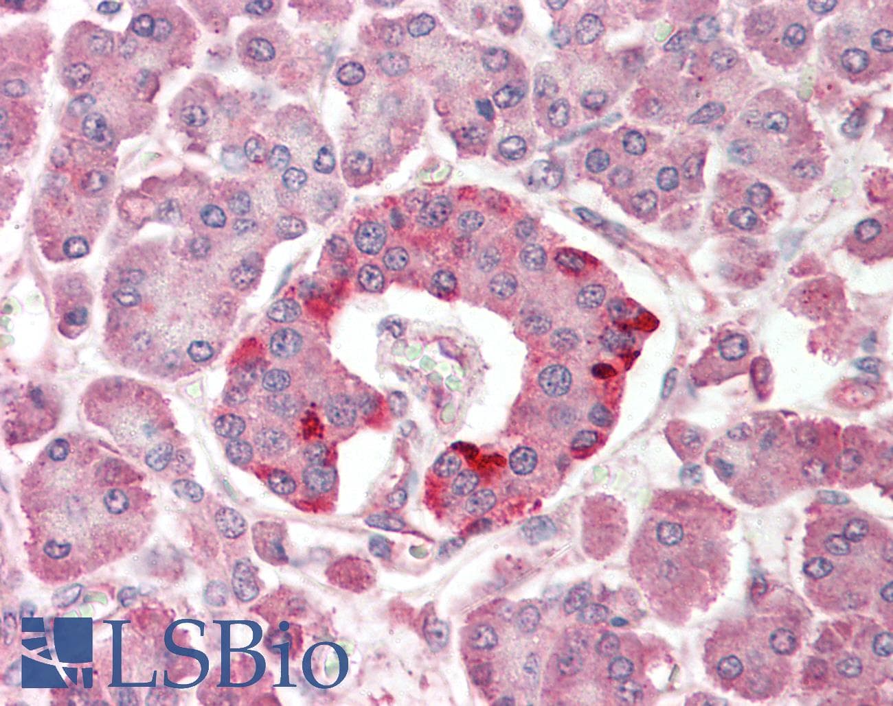 IHC-plus™ Polyclonal Rabbit anti-Human SCOP / PHLPP Antibody (IHC, IF, WB)
