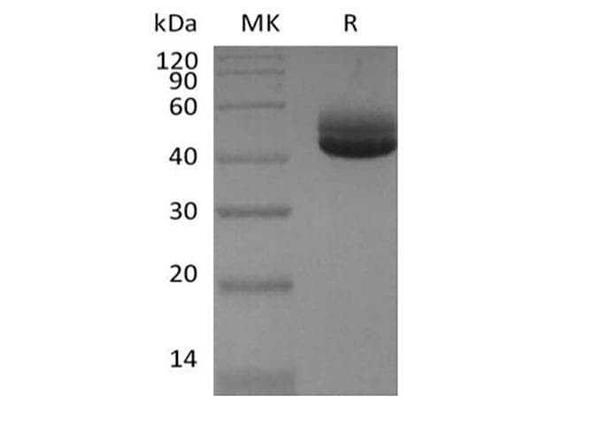 Human IL4 Protein (Recombinant Fc, C-terminus)