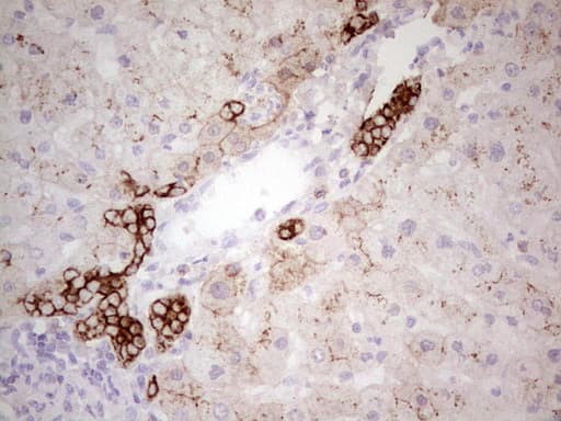 Monoclonal Mouse anti-Human ABCB1 / MDR1 / P Glycoprotein Antibody (clone OTI11D2, aa995-1280, IHC)