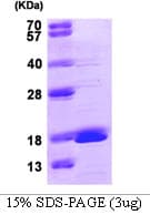 Human GMFG Protein (Recombinant)