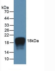Human IL2 Protein (Recombinant His, N-Terminal)