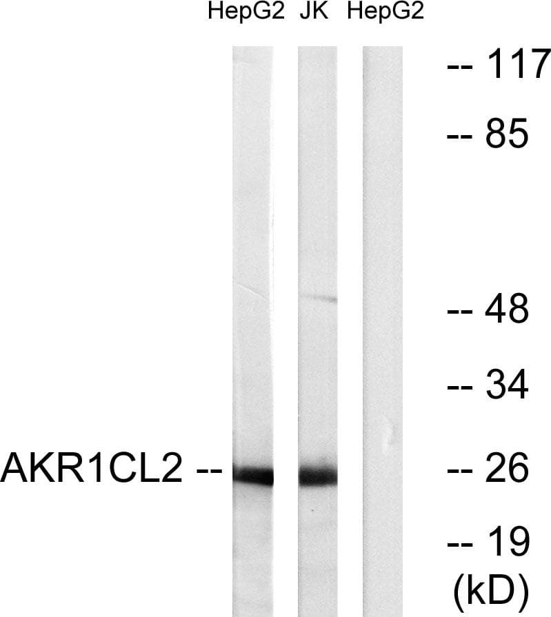 AKR1E2 Antibody