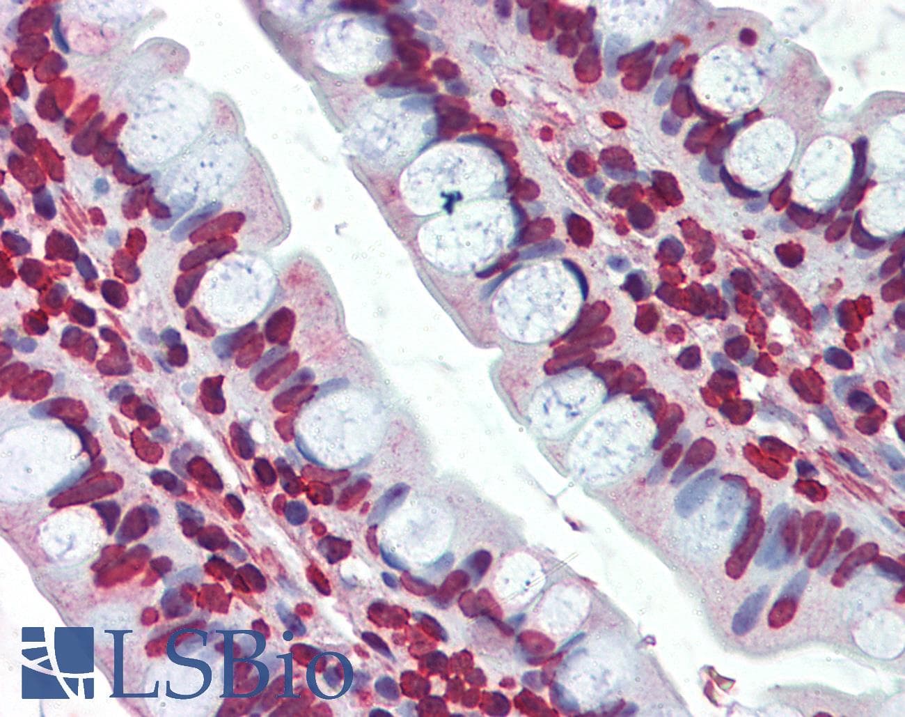 IHC-plus™ EPHA2 / EPH Receptor A2 Antibody (clone 1B3C7)
