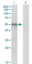 MKNK1 / MNK1 Antibody (clone 3E1)