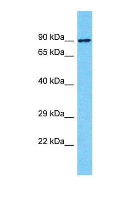 Polyclonal Rabbit anti-Human NBPF10 Antibody (aa656-705, WB)