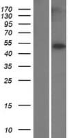 TUBB8 / Tubulin Beta 8 Protein (Over-Expression Lysate Myc-DDK (Flag))