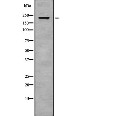 ABCA3 Antibody (aa485-535)