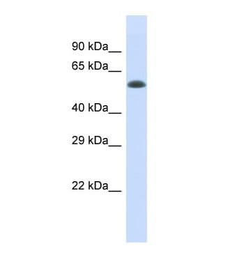 Polyclonal Rabbit anti-Human ELP4 Antibody (aa302-351, WB)