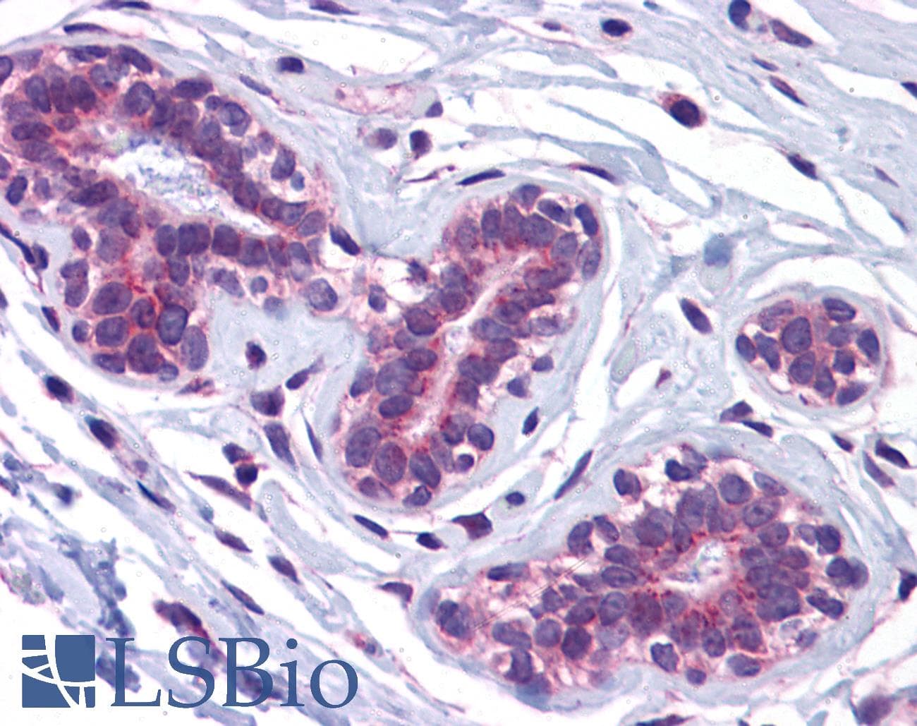 IHC-plus™ Polyclonal Rabbit anti-Human USP10 Antibody (IHC, IF, WB)