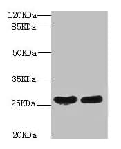 CRP / C-Reactive Protein Antibody