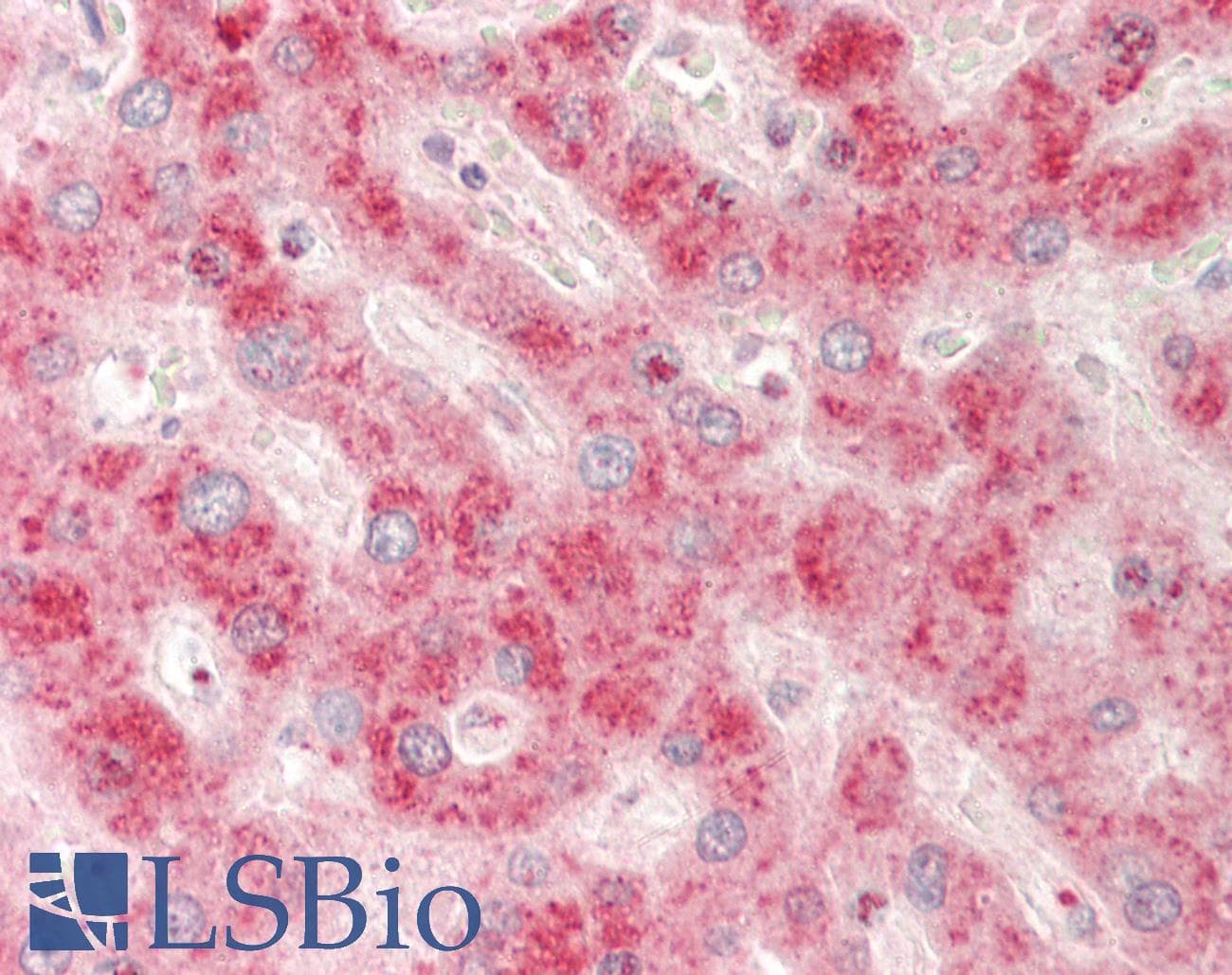 IGFBP2 / IGF-BP53 Antibody (aa215-264)