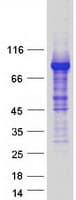 Human ZBTB16 / PLZF Protein (Recombinant Myc-DDK (Flag))