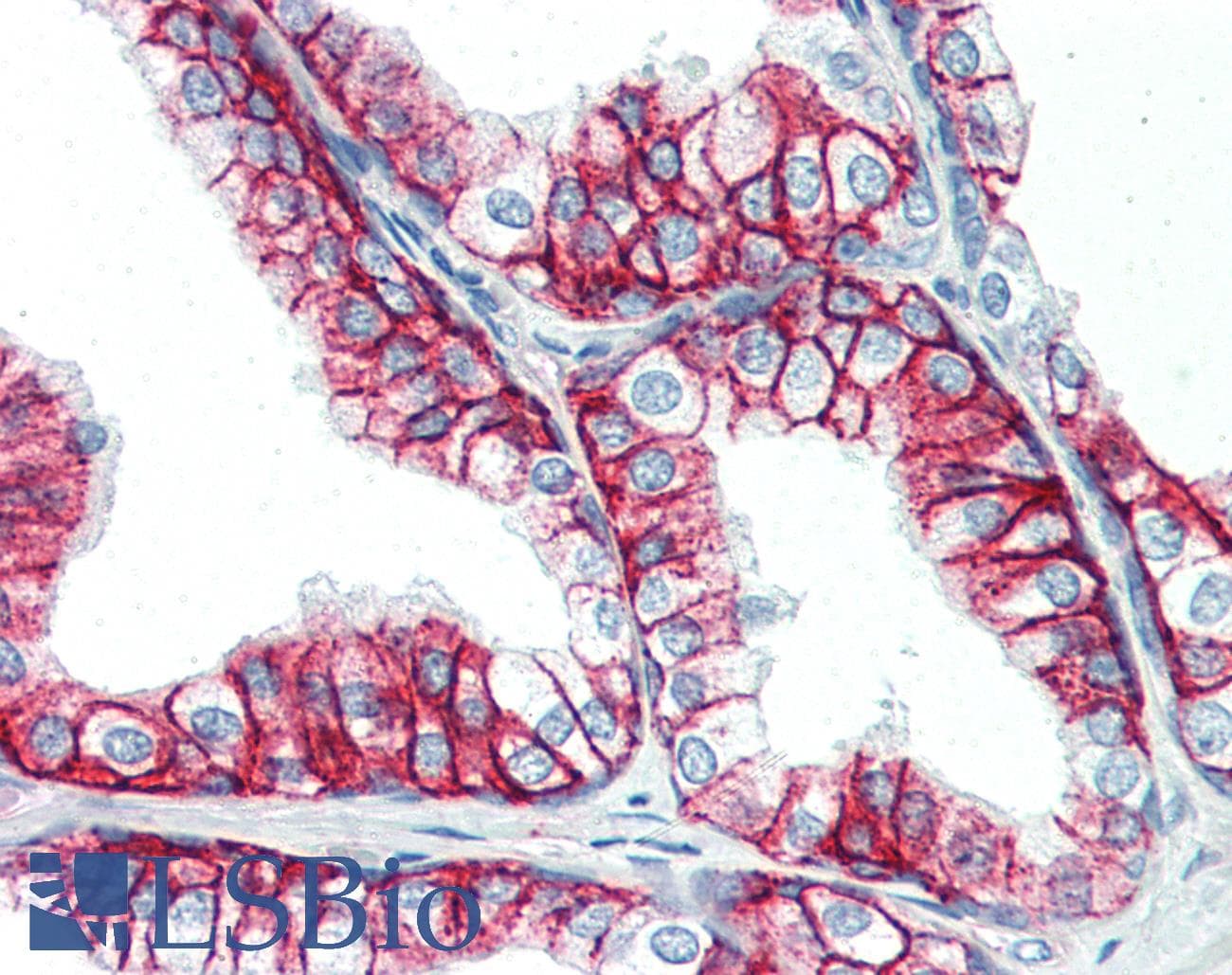 IHC-plus™ Monoclonal Mouse anti-Human Basigin / Emmprin / CD147 Antibody (IHC)