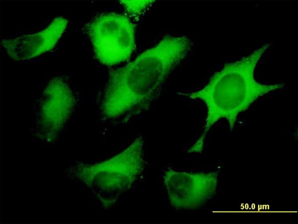 Monoclonal Mouse anti-Human FASN / Fatty Acid Synthase Antibody (clone 3F2-1F3, IF, WB)