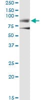 Monoclonal Mouse anti-Human DMD / Dystrophin Antibody (clone 3A11, WB)