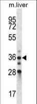 BLVRA Antibody (aa201-230)