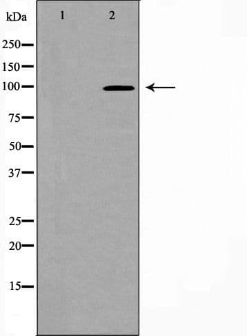 Polyclonal Rabbit anti-Human DLG4 / PSD95 Antibody (IHC, WB)