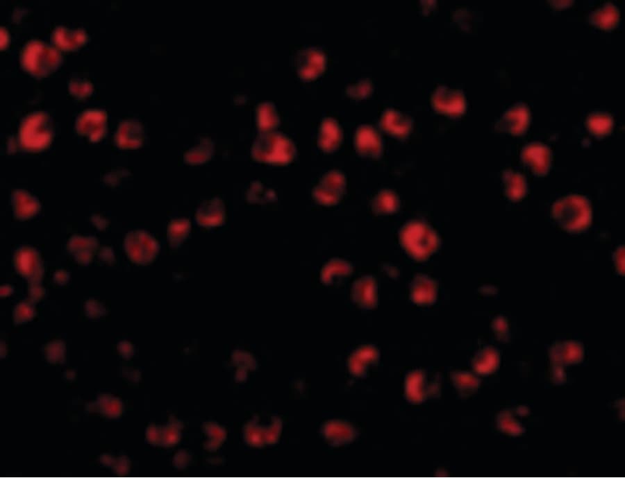 IHC-plus™ Polyclonal Rabbit anti-Human OTUD4 Antibody (IHC, IF, WB)