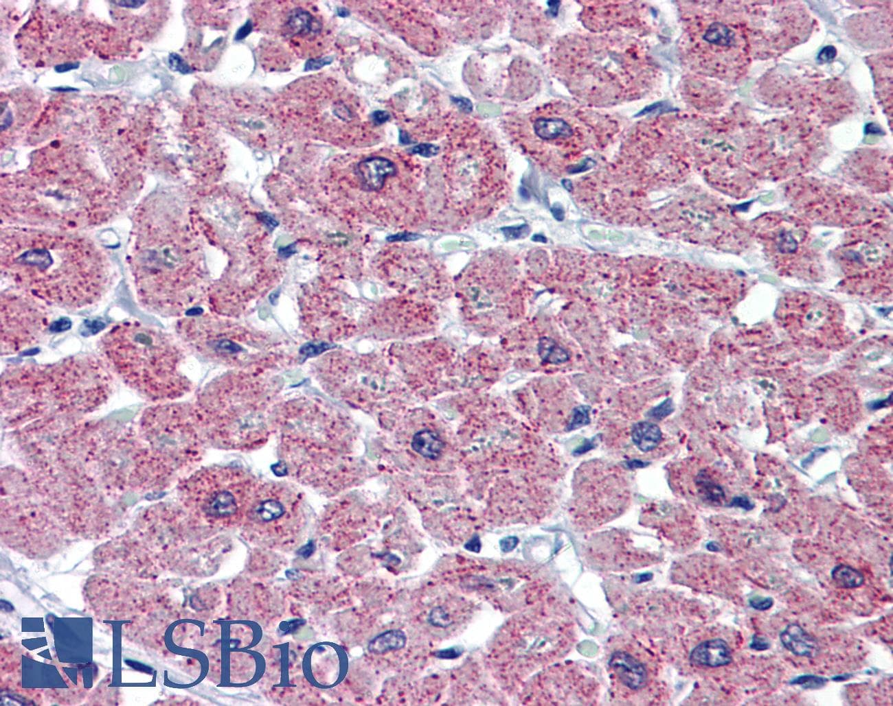 IHC-plus™ Monoclonal Mouse anti-Human CASQ2 / Calsequestrin 2 Antibody (clone 1C6, IHC, WB)