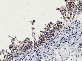 15-PGDH / HPGD Antibody (clone OTI2C10)