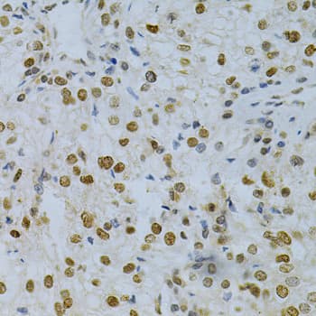 ELAVL1 / HUR Antibody