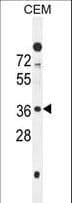 SFR1 / C10orf78 Antibody (aa1-30)
