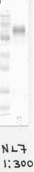 CYBB / NOX2 / gp91phox Antibody (clone NL7)