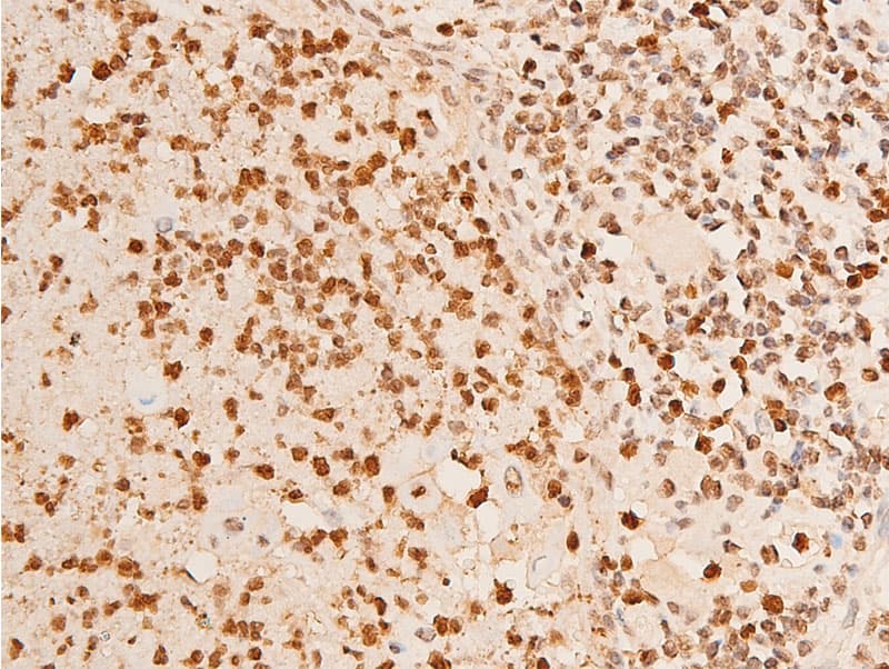 Polyclonal Rabbit anti-Human CHEK2 / CHK2 Antibody (phospho-Thr383, IHC, IF, WB)