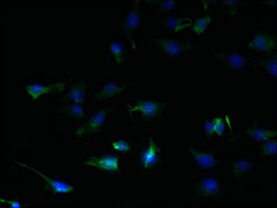 Polyclonal Rabbit anti-Human SFXN2 Antibody (IHC)