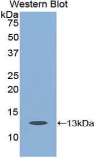CASP6 / Caspase 6 Antibody (aa194-293)